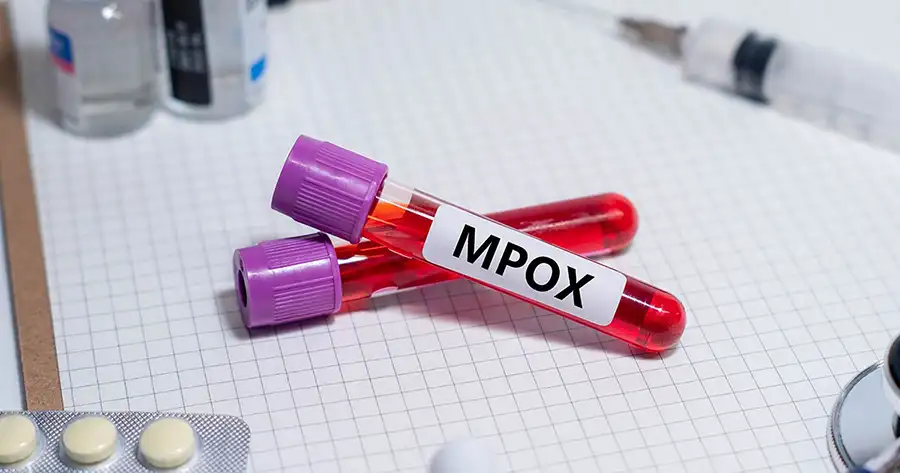 mpox vaccine and other preventive methods